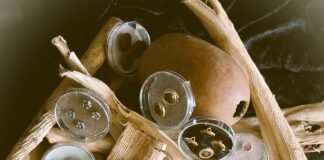 Buttons, Glorious Buttons