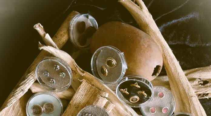 Buttons, Glorious Buttons